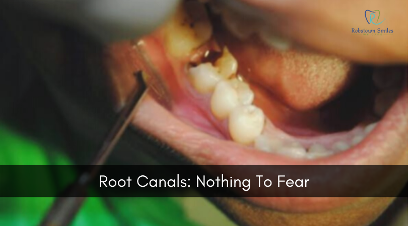 Root-Canals-Nothing-To-Fear