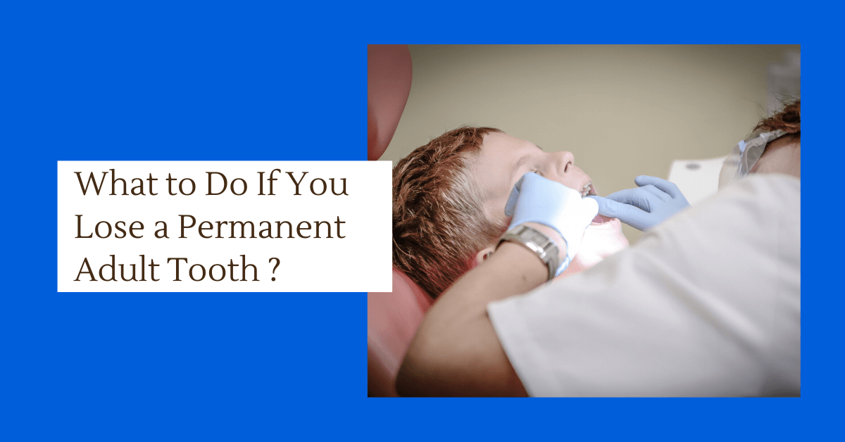 What to do If You Lose an Adult Tooth