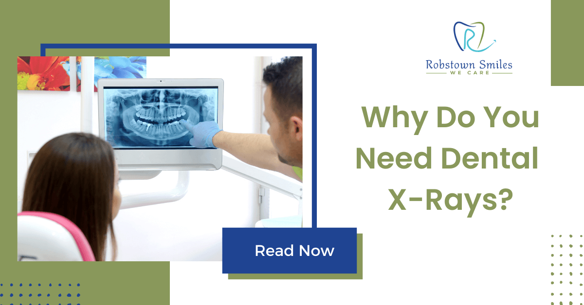 Why Do You Need Dental XRays? Robstown Smiles
