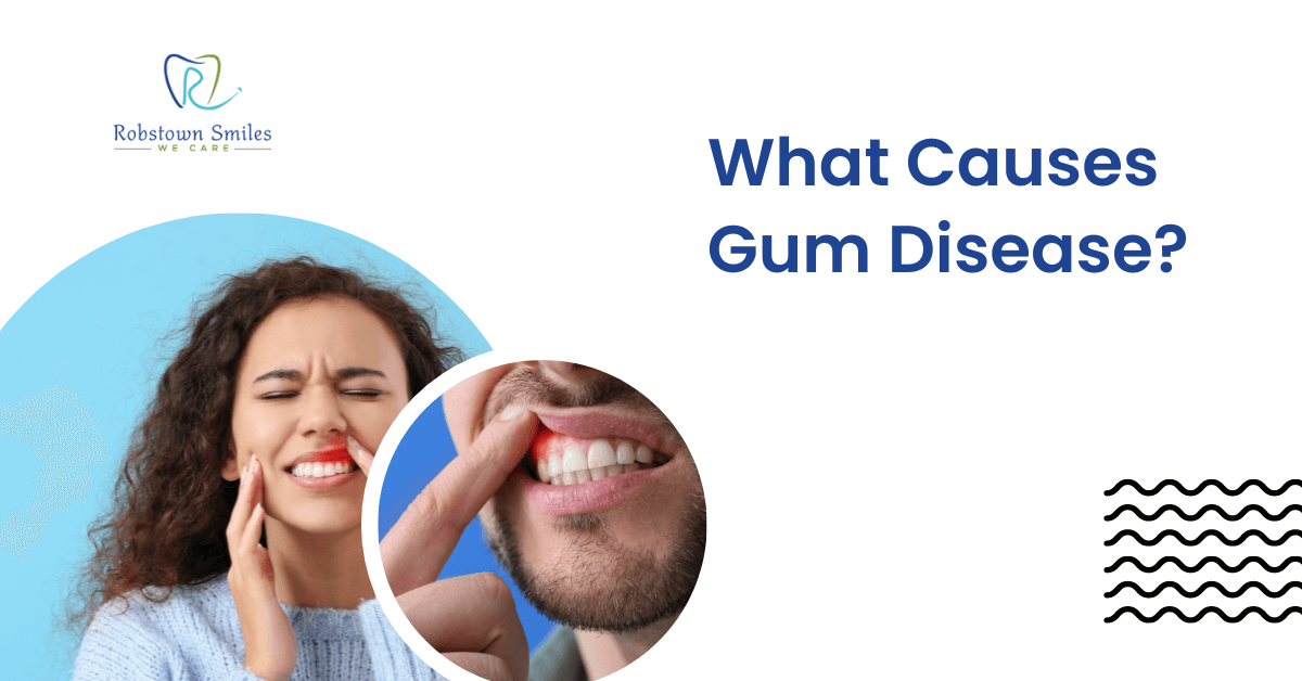 What Causes Gum Disease?