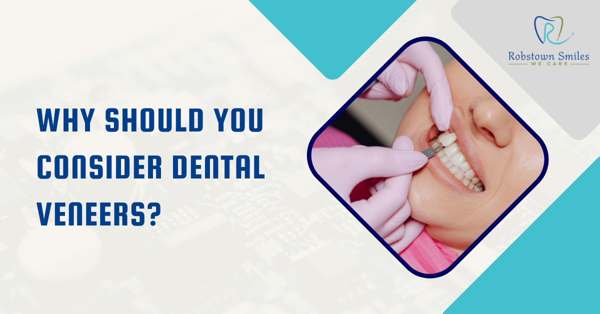 Why Should You Consider Dental Veneers?