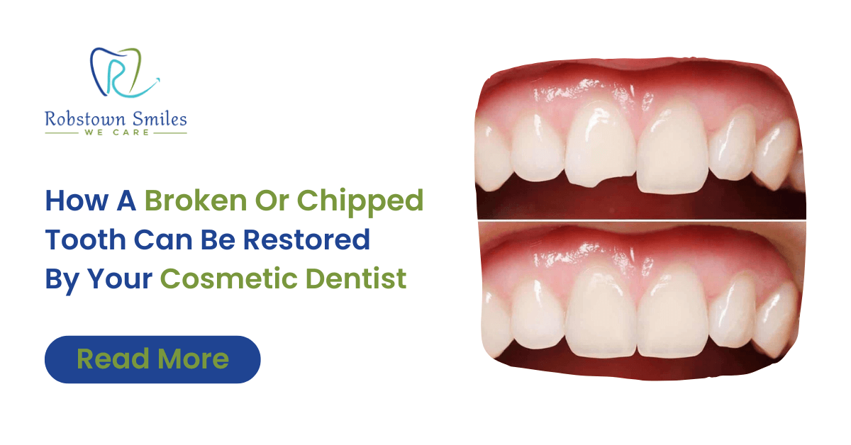 How A Broken Or Chipped Tooth Can Be Restored By Your Cosmetic Dentist