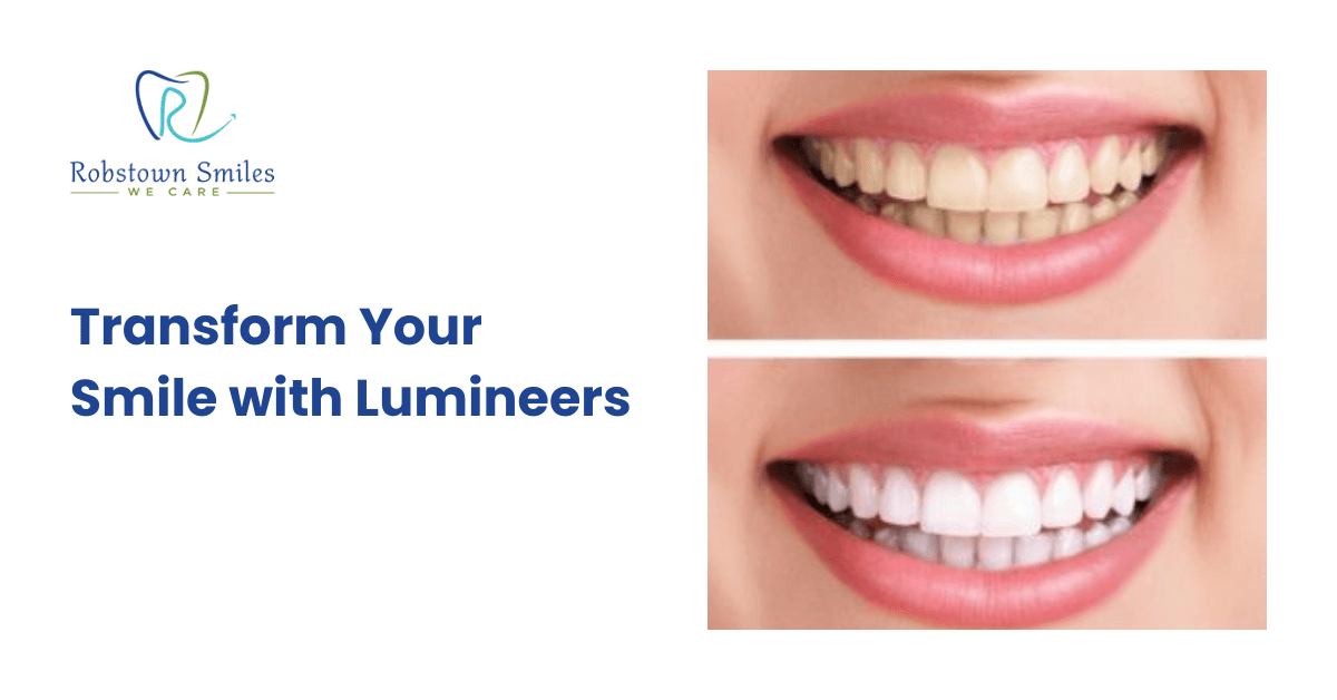 Transform Your Smile with Lumineers