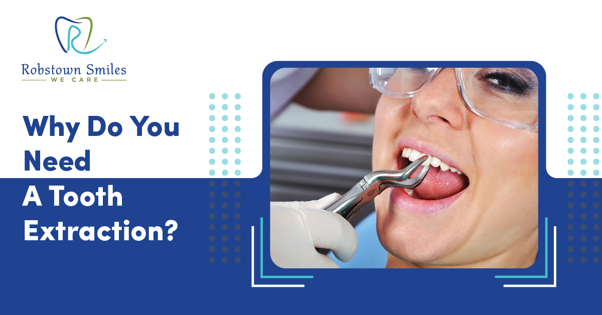 Why Do You Need A Tooth Extraction?