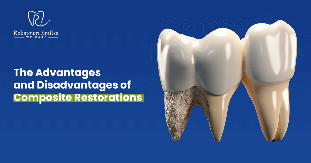 The Advantages and Disadvantages of Composite Restorations