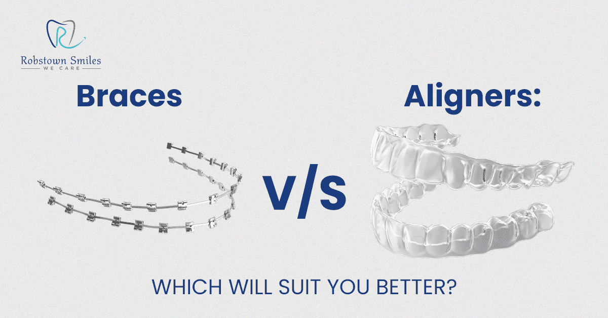 Braces vs. Aligners: Which Will Suit You Better?