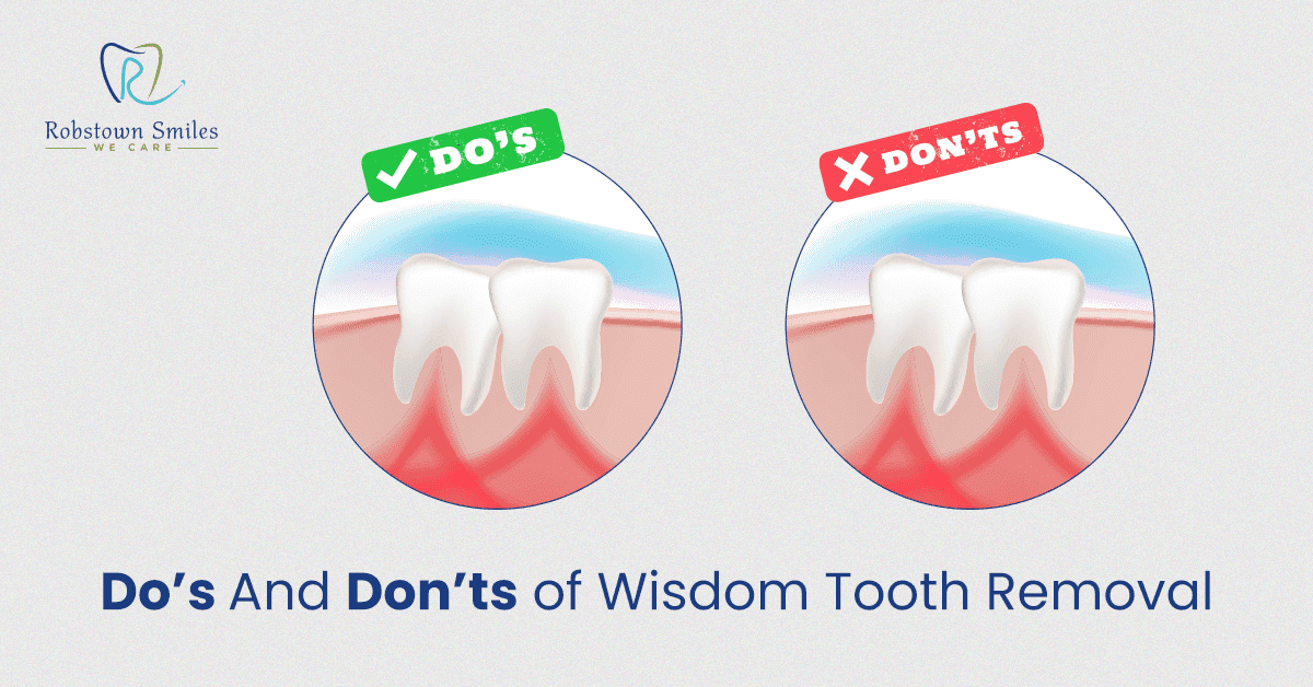 Do’s And Don’ts of Wisdom Tooth Removal