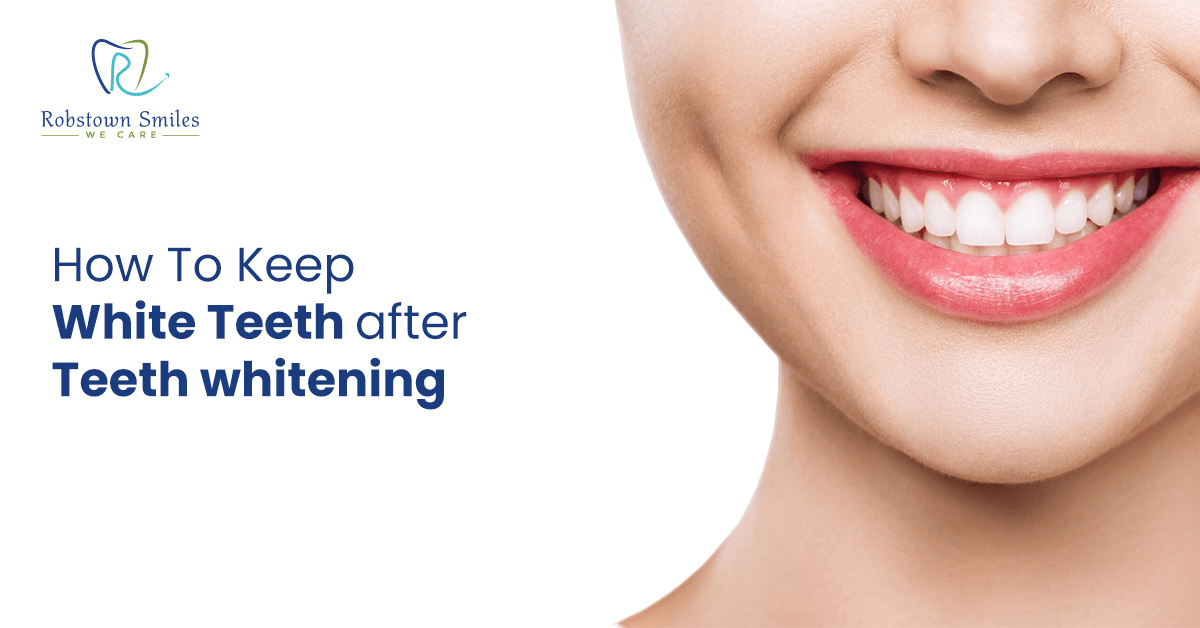 How To Keep White Teeth after teeth whitening?