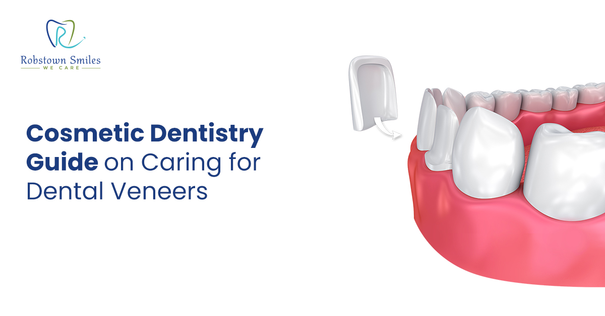 Cosmetic Dentistry Guide on Caring for Dental Veneers