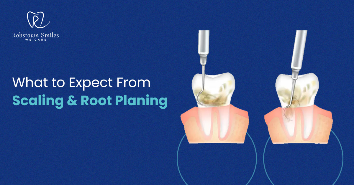 Scaling and Root Planning