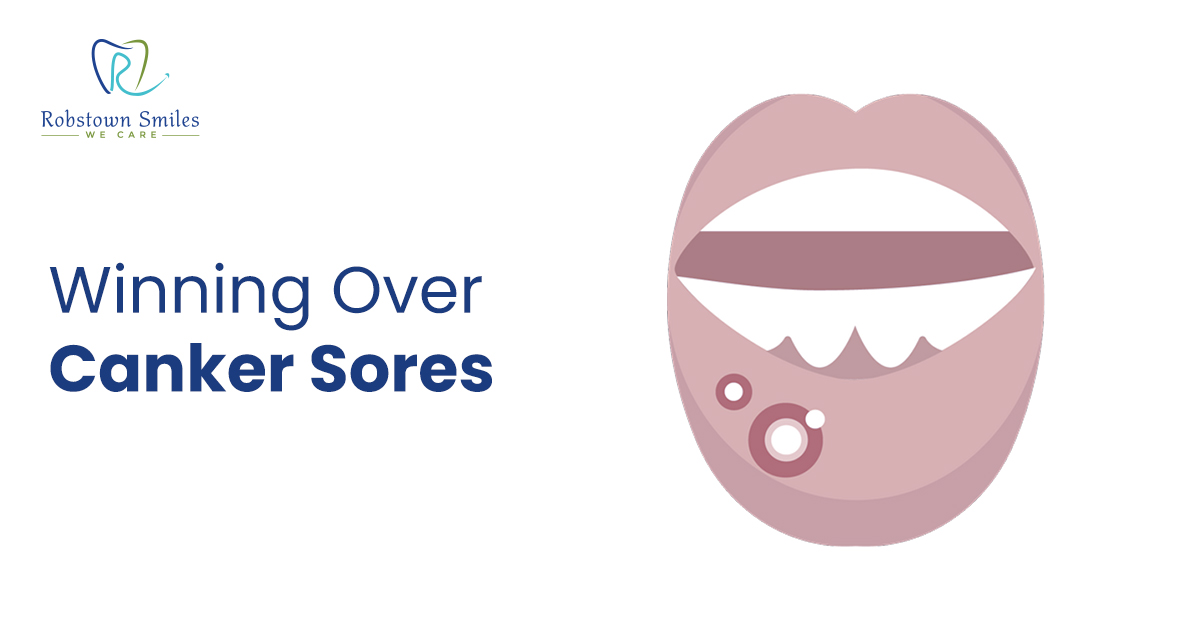 Winning Over Canker Sores