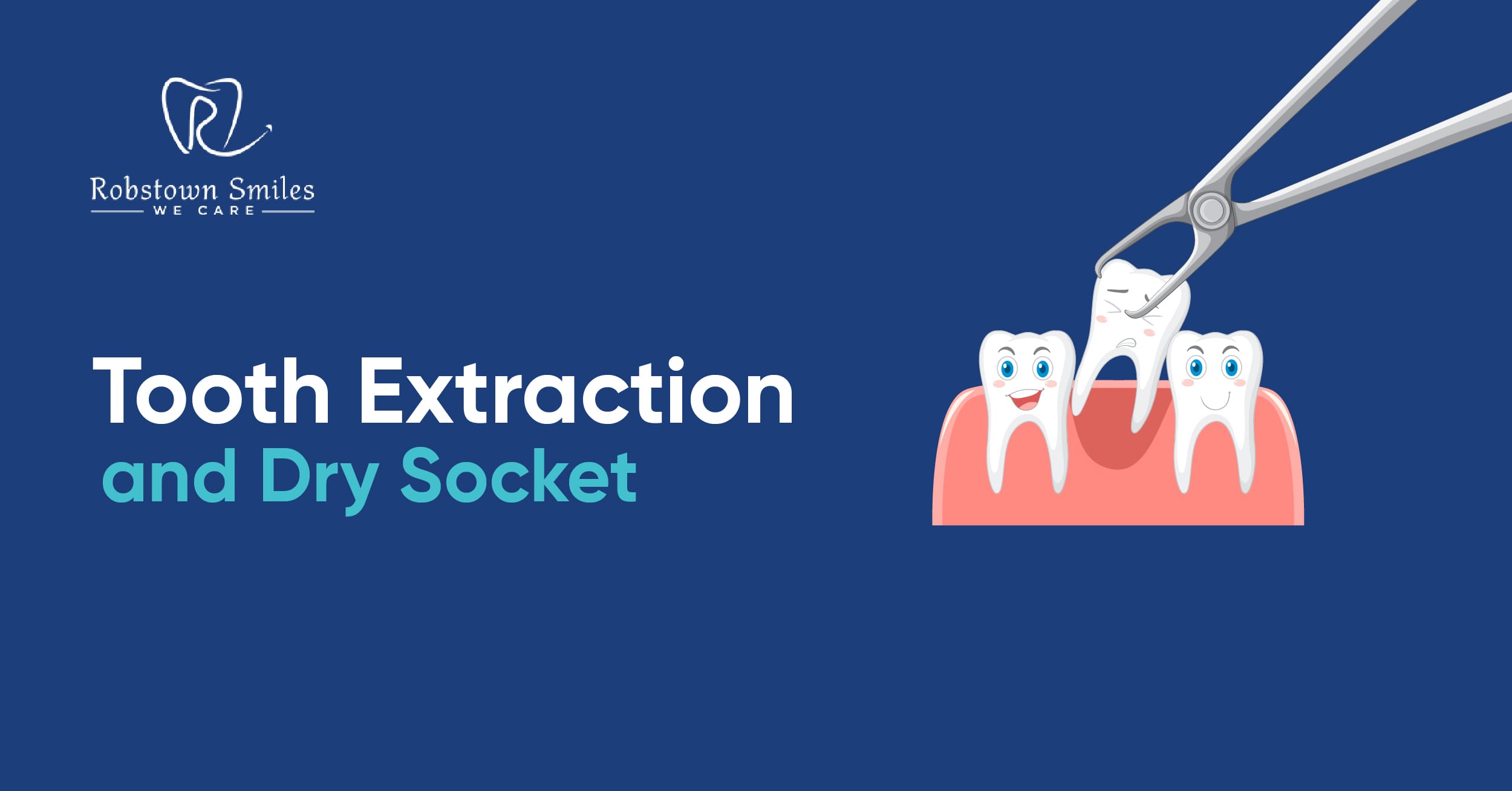 Tooth Extraction and Dry Socket