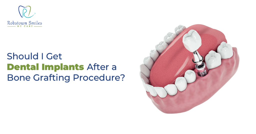 Should I Get Dental Implants After a Bone Grafting Procedure ...