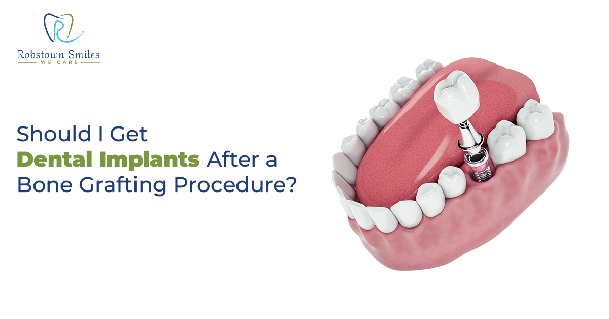 Should I Get Dental Implants After a Bone Grafting Procedure?