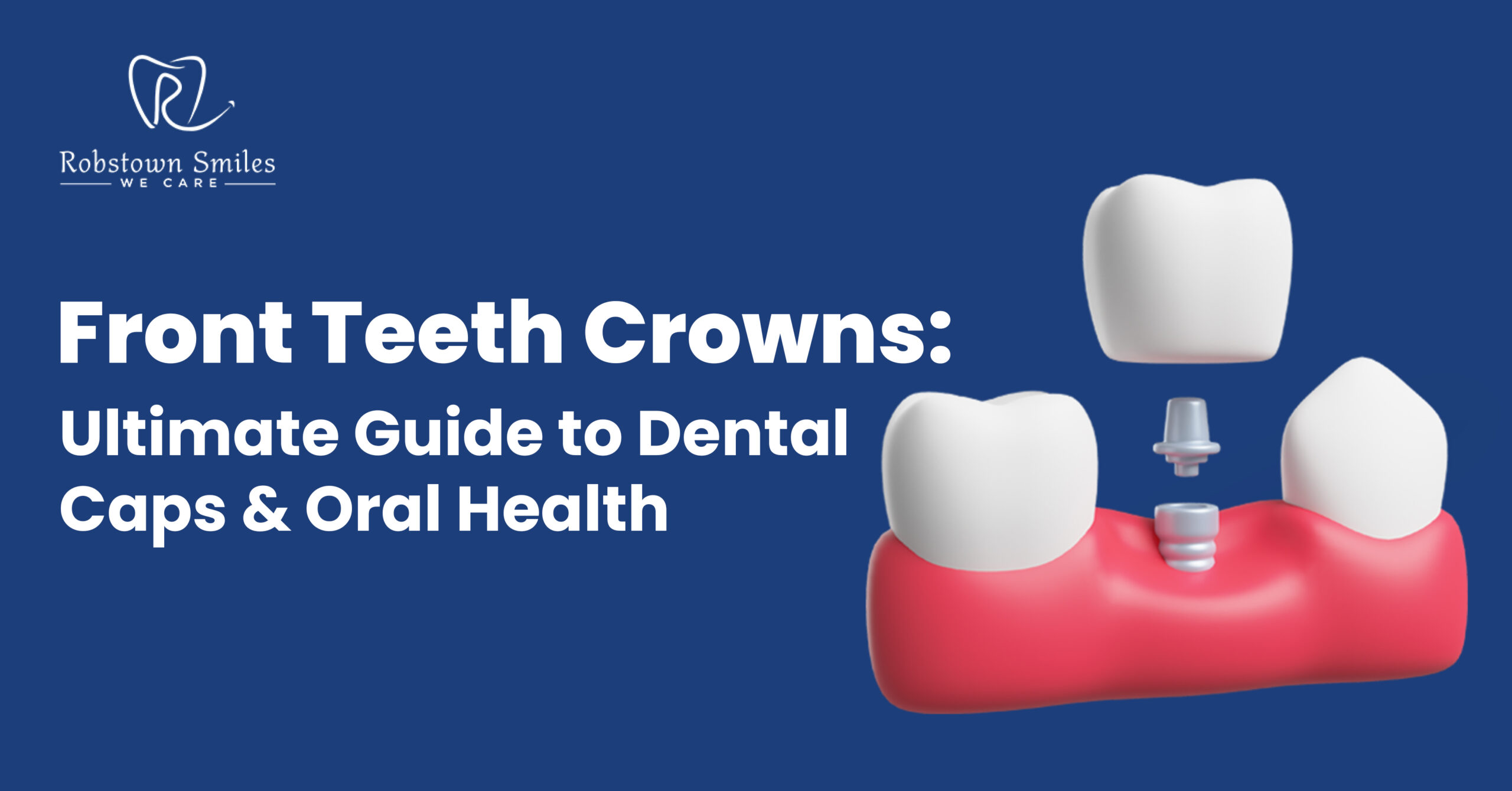 Front Teeth Crowns: Ultimate Guide to Dental Caps and Oral Health