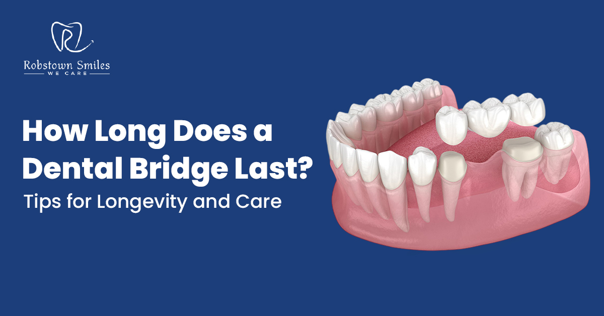 How Long Does a Dental Bridge Last? Tips for Longevity and Care