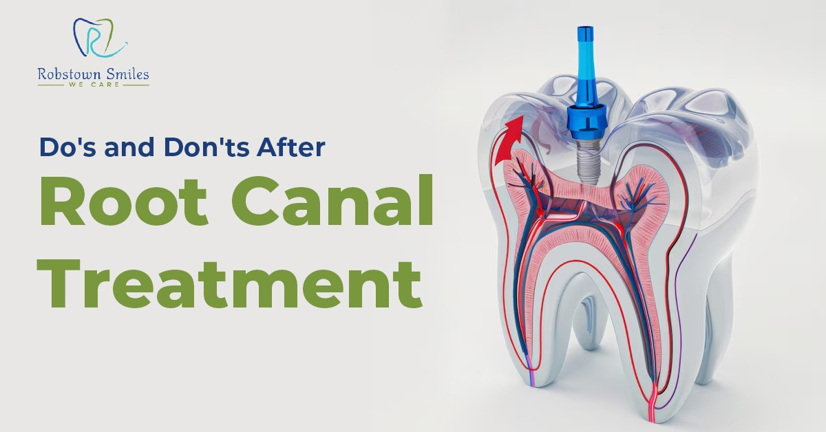 Do’s and Don’ts After Root Canal Treatment